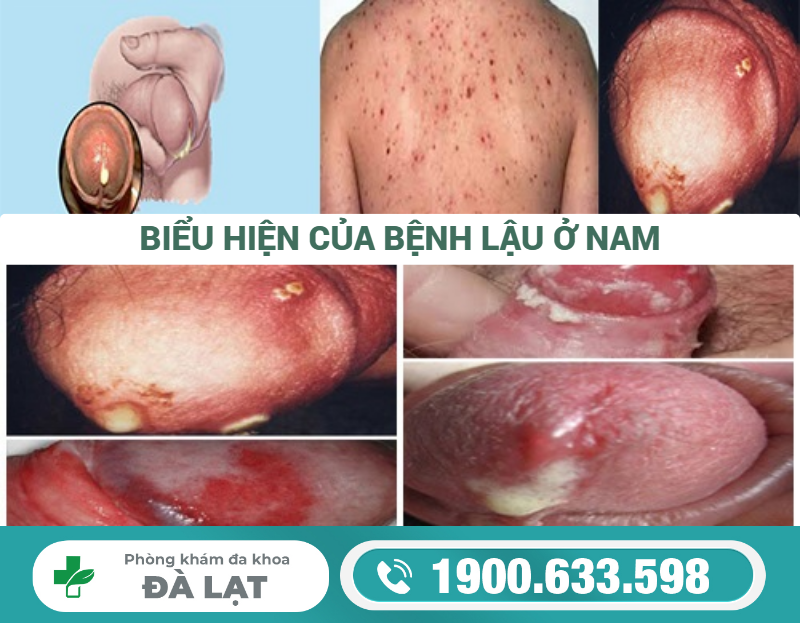 Hình ảnh minh họa